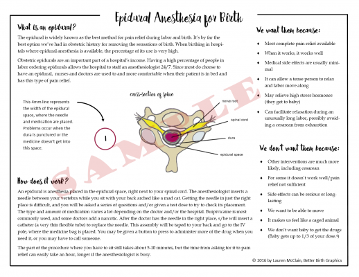 Pros And Cons Of An Epidural: Fact Sheet - Better Birth Blog