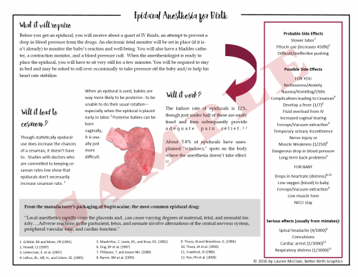 epidural fact sheet, risks epidural, handout research